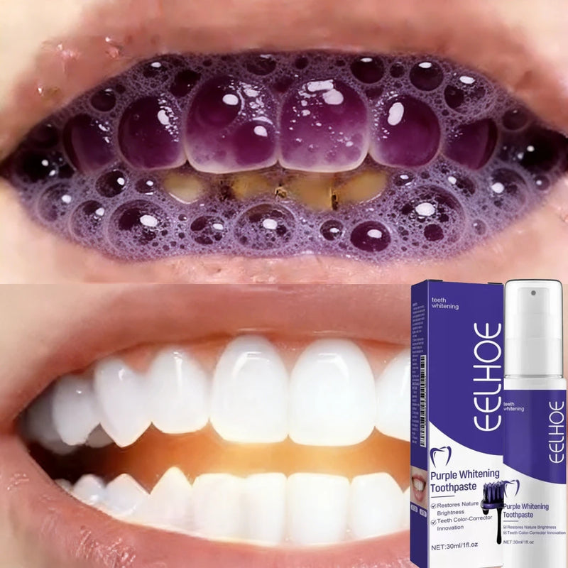 Teeth Whitening Toothpaste for Yellow Teeth